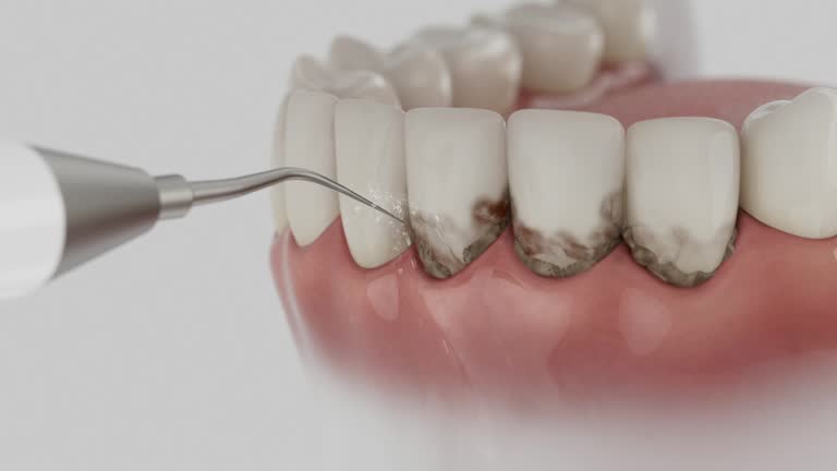 Trusted Dental Implants service in Macon, IL - Dentist Open Now